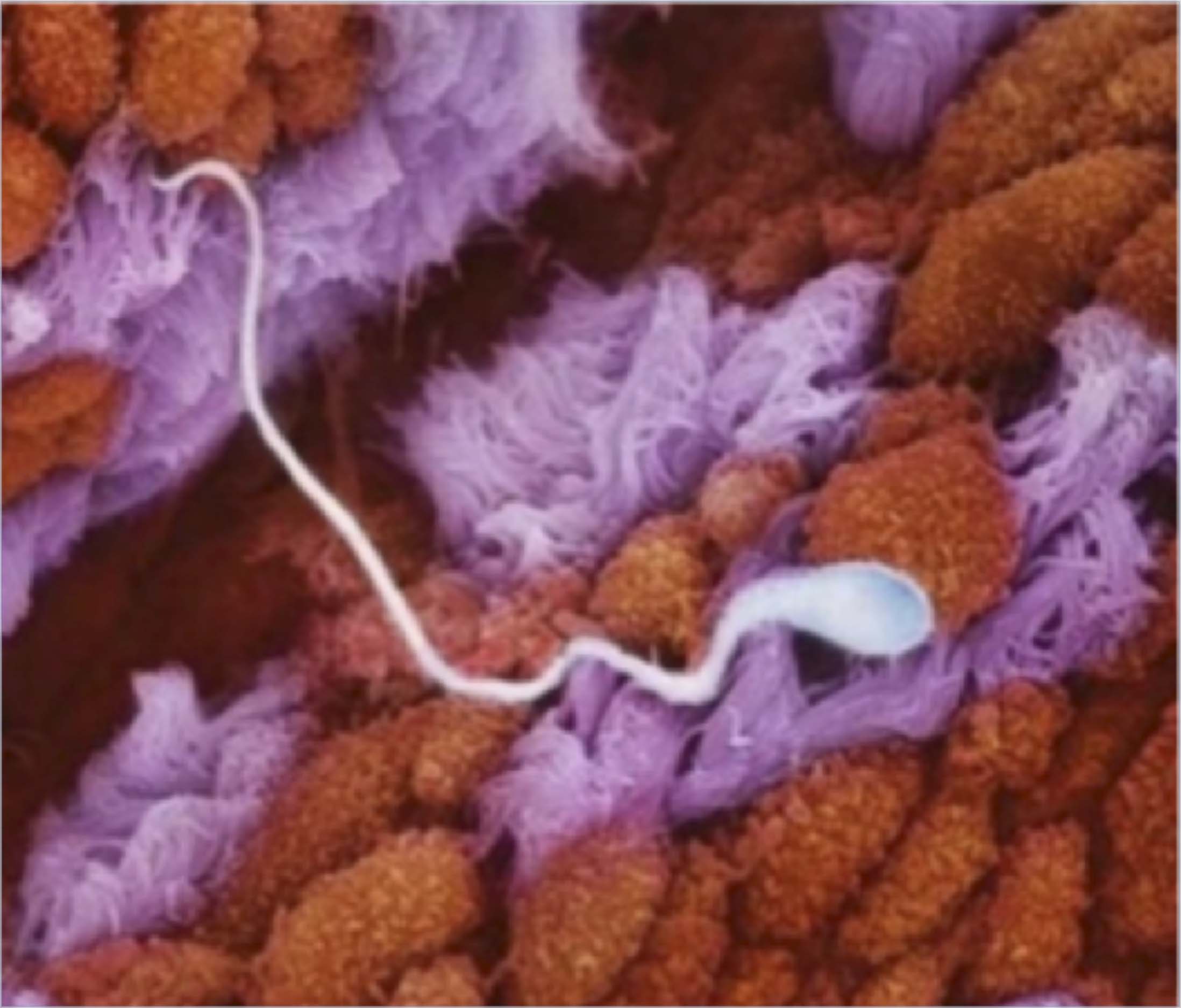 Сперматозоид в маточной трубе